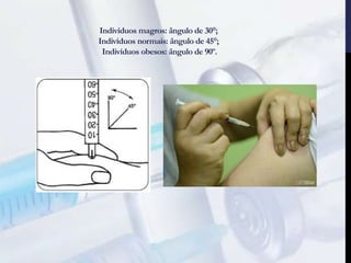 Indivíduos magros: ângulo de 30°;
Indivíduos normais: ângulo de 45°;
Indivíduos obesos: ângulo de 90º.
 