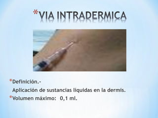 *Definición.-
Aplicación de sustancias líquidas en la dermis.
*Volumen máximo: 0,1 ml.
 