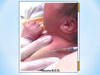 Vacuna B.C.G.
 