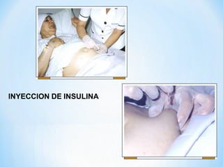INYECCION DE INSULINA
 