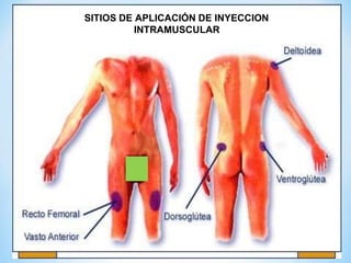 SITIOS DE APLICACIÓN DE INYECCION
INTRAMUSCULAR
 