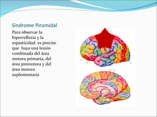Síndrome Piramidal <ul><li>Para observar la hiperreflexia y la espasticidad  es preciso que  haya una lesión combinada del...