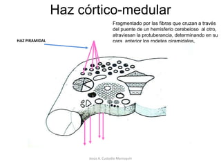 Vía piramidal Comprende los haces:Córtico-medular (directo y cruzado)y Córtico-nuclearJesús A. Custodio Marroquín