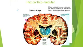 Haz córtico-medular
El axón de esta neurona desciende
por la cápsula interna de la sustancia
blanca hacia el pedúnculo cerebral.CAPSULA INTERNA
 