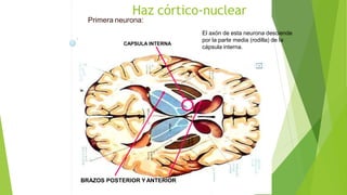 Haz córtico-nuclear
Primera neurona:
El axón de esta neurona desciende
por la parte media (rodilla) de la
cápsula interna.
CAPSULA INTERNA
BRAZOS POSTERIOR Y ANTERIOR
 