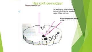 Haz córtico-nuclearSegunda neurona:
Se agota en la mitad inferior del
bulbo en el núcleo del hipogloso
mayor, XII par craneal .
NERVIO HIPOGLOSO MAYOR
XII PAR
 