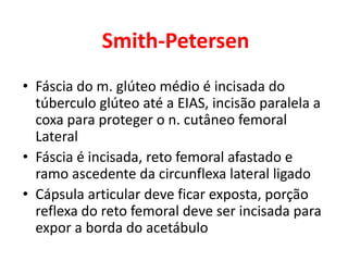 Smith-Petersen
• Fáscia do m. glúteo médio é incisada do
túberculo glúteo até a EIAS, incisão paralela a
coxa para proteger o n. cutâneo femoral
Lateral
• Fáscia é incisada, reto femoral afastado e
ramo ascedente da circunflexa lateral ligado
• Cápsula articular deve ficar exposta, porção
reflexa do reto femoral deve ser incisada para
expor a borda do acetábulo
 