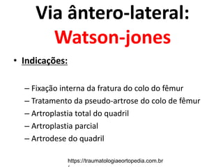 Via ântero-lateral:
Watson-jones
• Indicações:
– Fixação interna da fratura do colo do fêmur
– Tratamento da pseudo-artrose do colo de fêmur
– Artroplastia total do quadril
– Artroplastia parcial
– Artrodese do quadril
https://traumatologiaeortopedia.com.br
 