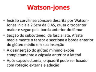 Watson-jones
• Incisão curvilínea côncava descrita por Watson-
Jones inicia a 2,5cm da EIAS, cruza o trocanter
maior e segue pela borda anterior do fêmur
• Secção do subcutâneo, da fáscia lata. Afasta
medialmente o tensor e secciona a borda anterior
do glúteo médio em sua inserção
• A desinserção do glúteo mínimo expõe
completamente a cápsula anterior a lateral
• Após capsulectomia, o quadril pode ser luxado
com rotação externa e adução
 
