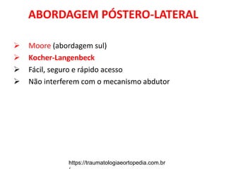 ABORDAGEM PÓSTERO-LATERAL
 Moore (abordagem sul)
 Kocher-Langenbeck
 Fácil, seguro e rápido acesso
 Não interferem com o mecanismo abdutor
https://traumatologiaeortopedia.com.br
 