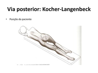Via posterior: Kocher-Langenbeck
• Posição do paciente
 