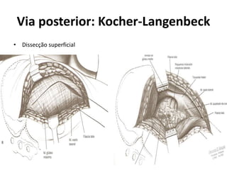 Via posterior: Kocher-Langenbeck
• Dissecção superficial
 