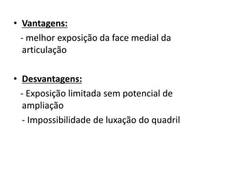 • Vantagens:
- melhor exposição da face medial da
articulação
• Desvantagens:
- Exposição limitada sem potencial de
ampliação
- Impossibilidade de luxação do quadril
 
