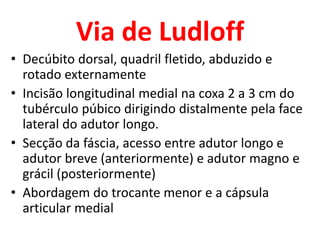 Via de Ludloff
• Decúbito dorsal, quadril fletido, abduzido e
rotado externamente
• Incisão longitudinal medial na coxa 2 a 3 cm do
tubérculo púbico dirigindo distalmente pela face
lateral do adutor longo.
• Secção da fáscia, acesso entre adutor longo e
adutor breve (anteriormente) e adutor magno e
grácil (posteriormente)
• Abordagem do trocante menor e a cápsula
articular medial
 