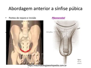 Abordagem anterior a sínfise púbica
• Pontos de reparo e incisão Pfannenstiel
• Fig 7-6
https://traumatologiaeortopedia.com.br
 
