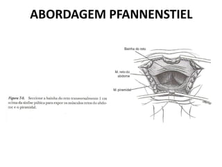 ABORDAGEM PFANNENSTIEL
 