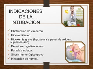 INDICACIONES
DE LA
INTUBACIÓN
 Obstrucción de vía aérea
 Hipoventilación
 Hipoxemia grave (hipoxemia a pesar de oxígeno
suplementario)
 Deterioro cognitivo severo
 Parada cardiaca,
 Shock hemorrágico grave
 Inhalación de humos.
 