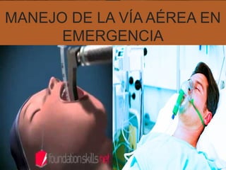 MANEJO DE LA VÍA AÉREA EN
EMERGENCIA
 
