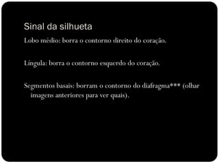 Sinal da silhueta
Lobo médio: borra o contorno direito do coração.

Língula: borra o contorno esquerdo do coração.

Segmentos basais: borram o contorno do diafragma*** (olhar
  imagens anteriores para ver quais).
 