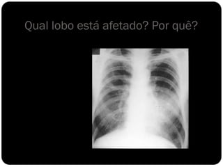 Qual lobo está afetado? Por quê?
 