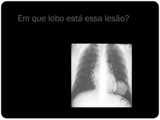Em que lobo está essa lesão?
 