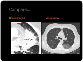 Compare...
Consolidação   Vidro-fosco
 