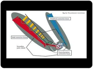 Figura do “Computed Tomography of the lung...”(Baert 2007)
 