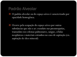 Padrão Alveolar
 O padrão alveolar ou do espaço aéreo é caracterizado por
   opacidade homogênea.

 Ocorre pela ocupação do espaço aéreo por outras
   substâncias que não o ar: exsudato nas pneumopatias,
   transudato nos edemas pulmonares, sangue, células
   neoplásicas e materiais estranhos no caso de aspiração (ex.
   aspiração de óleo mineral)
 