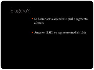 E agora?
            Se borrar aorta ascendente qual o segmento
             afetado?

            Anterior (LSD) ou segmento medial (LM)
 