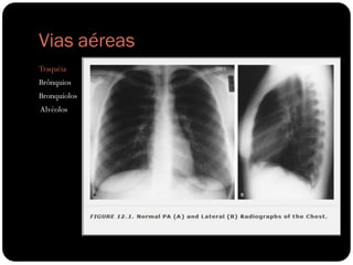 Vias aéreas
Traquéia
Brônquios
Bronquíolos
Alvéolos
 
