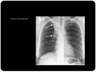 O que está anormal?
 