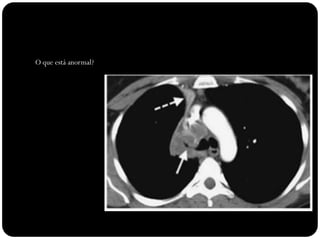 O que está anormal?
 