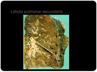 Lóbulo pulmonar secundário
 