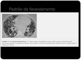 Padrão de faveolamento
 