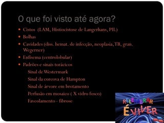 O que foi visto até agora?
 Cistos (LAM, Histiocistose de Langerhans, PIL)
 Bolhas
 Cavidades (diss. hemat. de infecção, neoplasia,TB, gran.
Wegerner)
 Enfisema (centrolobular)
 Padrões e sinais torácicos
Sinal deWestermark
Sinal da corcova de Hampton
Sinal de árvore em brotamento
Perfusão em mosaico ( X vidro fosco)
Faveolamento - fibrose
 