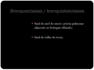 Bronquiectasias / bronquioloectasias
 Sinal do anel do sinete: artéria pulmonar
adjacente ao brônquio dilatado;
 Sinal do trilho do trem;
 