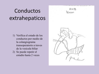 Conductos
extrahepaticos
1) Verifica el estado de los
conductos por medio de
la colangiograma
transoperatorio a traves
de la vesicula biliar
2) Se puede repetir el
estudio hasta 2 veces
 