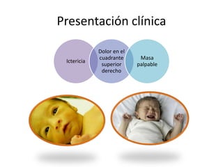 Presentación clínica
Ictericia
Dolor en el
cuadrante
superior
derecho
Masa
palpable
 