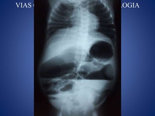 VIAS CENTRALES EN NEONATOLOGIA
 