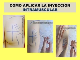 COMO APLICAR LA INYECCION
     INTRAMUSCULAR
 