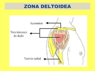 ZONA DELTOIDEA
 