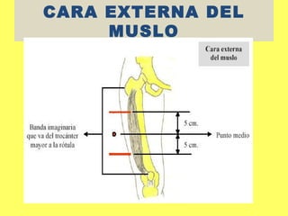 CARA EXTERNA DEL
     MUSLO
 