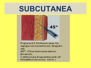 SUBCUTANEA
 