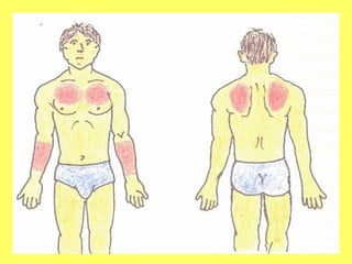 Vias de administracion