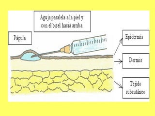 Vias de administracion