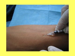 Vias de administracion