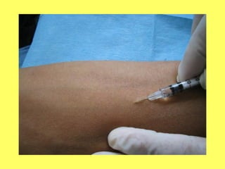 Vias de administracion