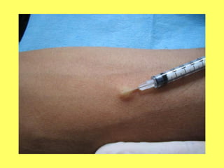 Vias de administracion