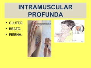 INTRAMUSCULAR
         PROFUNDA
• GLUTEO.
• BRAZO.
• PIERNA.
 