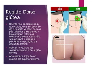 Região Dorso
glútea
▶ Orientarao paciente para
que coloque-se em posição
de decúbito ventral, com os
pés voltados para dentro –
Essa posição relaxa os
músculos glúteos. Caso não
seja possível, coloque o
paciente em posição de
decúbito lateral;
▶ Aplicar no quadrante
superior esquerdo da região
glútea;
▶ Administrar a injeção no
quadrante superior externo.
 